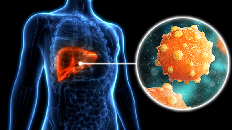 PAFI Malinau – Cara Mencegah Penyakit Hepatitis, Edukasi dan Kesadaran